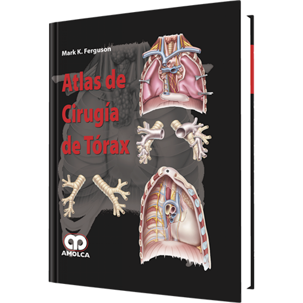 Ferguson Atlas de Cirugia de Torax