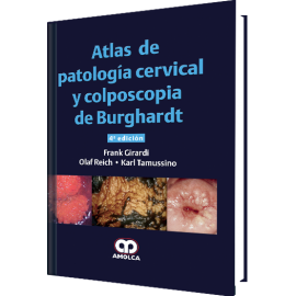Atlas de Patologia Cervical y Colposcopia de Burghardt - Frank Girardi