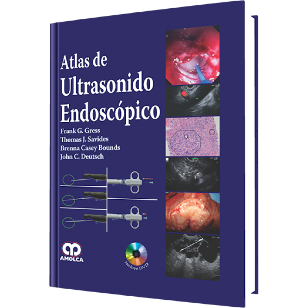 Gress - Atlas de Ultrasonido Endoscopico