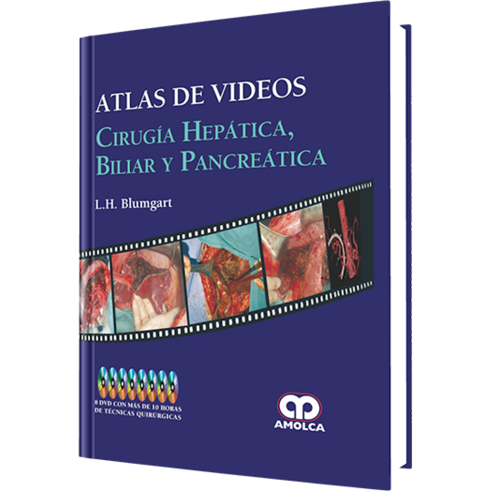 Blumgart Atlas de Videos . Cirugia Hepatica, Biliar y Pancreatica