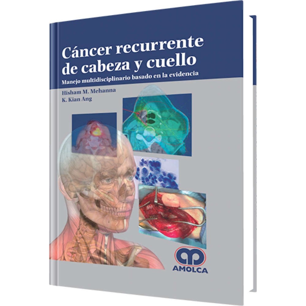 Cancer Recurrente de Cabeza y Cuello - Hisham M. Mehanna