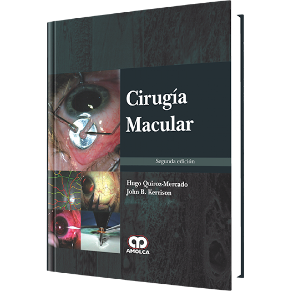 Quiroz - Cirugia Macular 2ª ed.