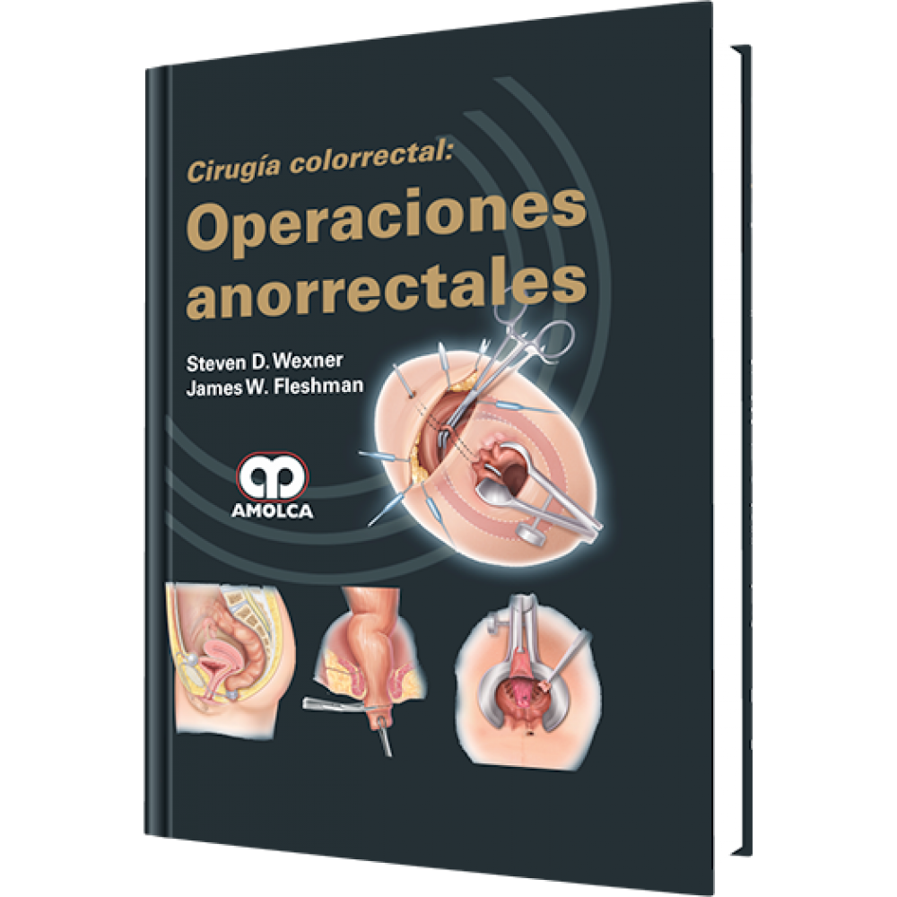 Wexner Cirugia colorrectal: Operaciones Anorrectales