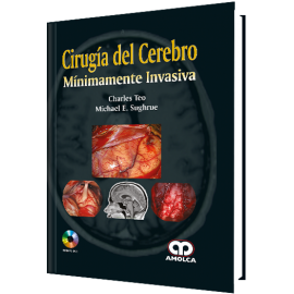 Teo Ch. - Cirugia del Cerebro Minimamente Invasiva