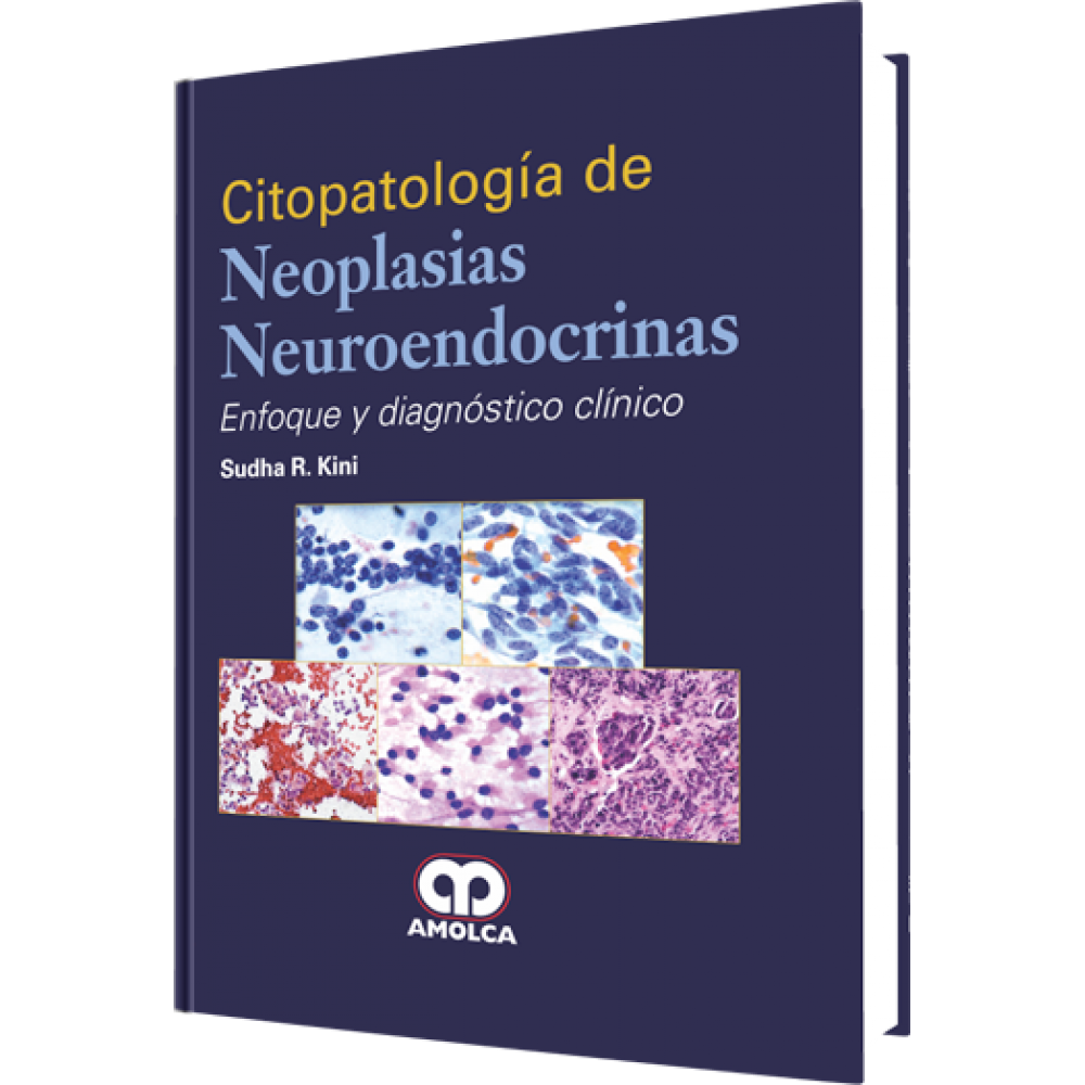 Kini Citopatologia de Neoplasias Neuroendocrinas