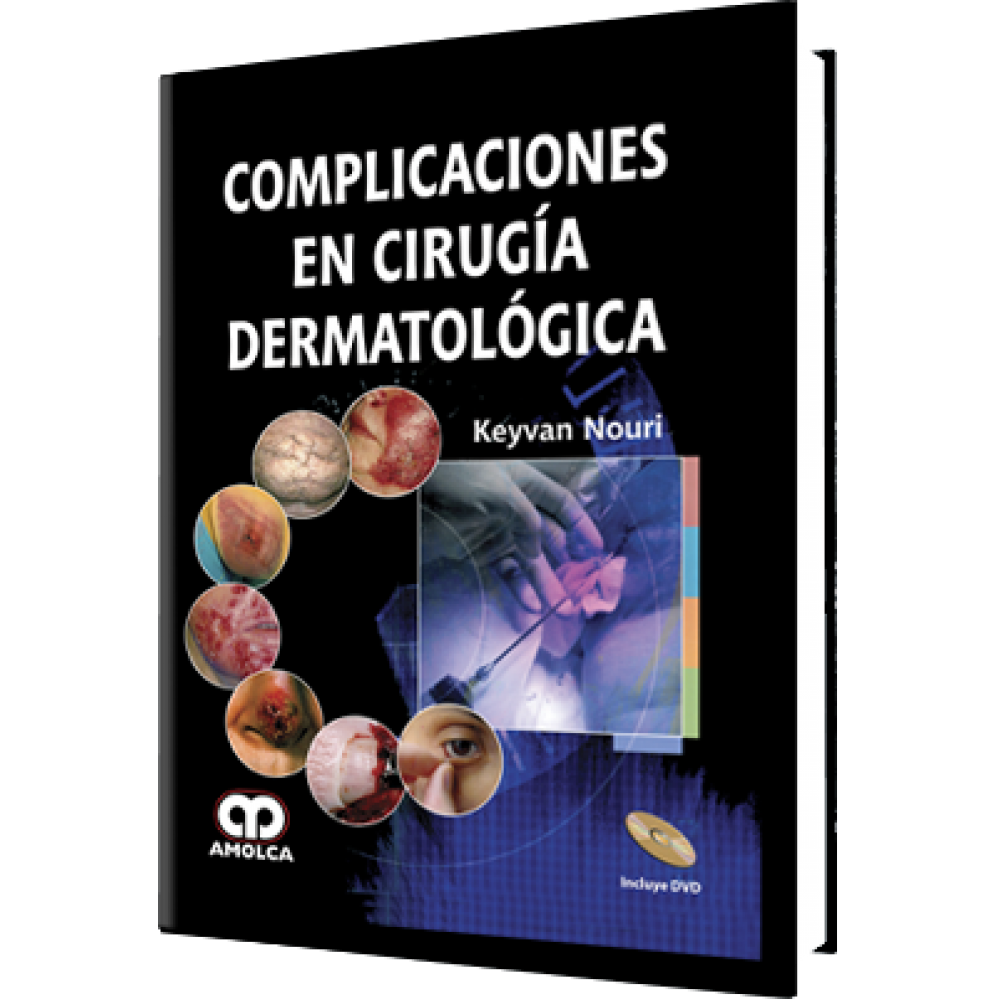 Complicaciones en Cirugia Dermatologica - Keyvan Nouri