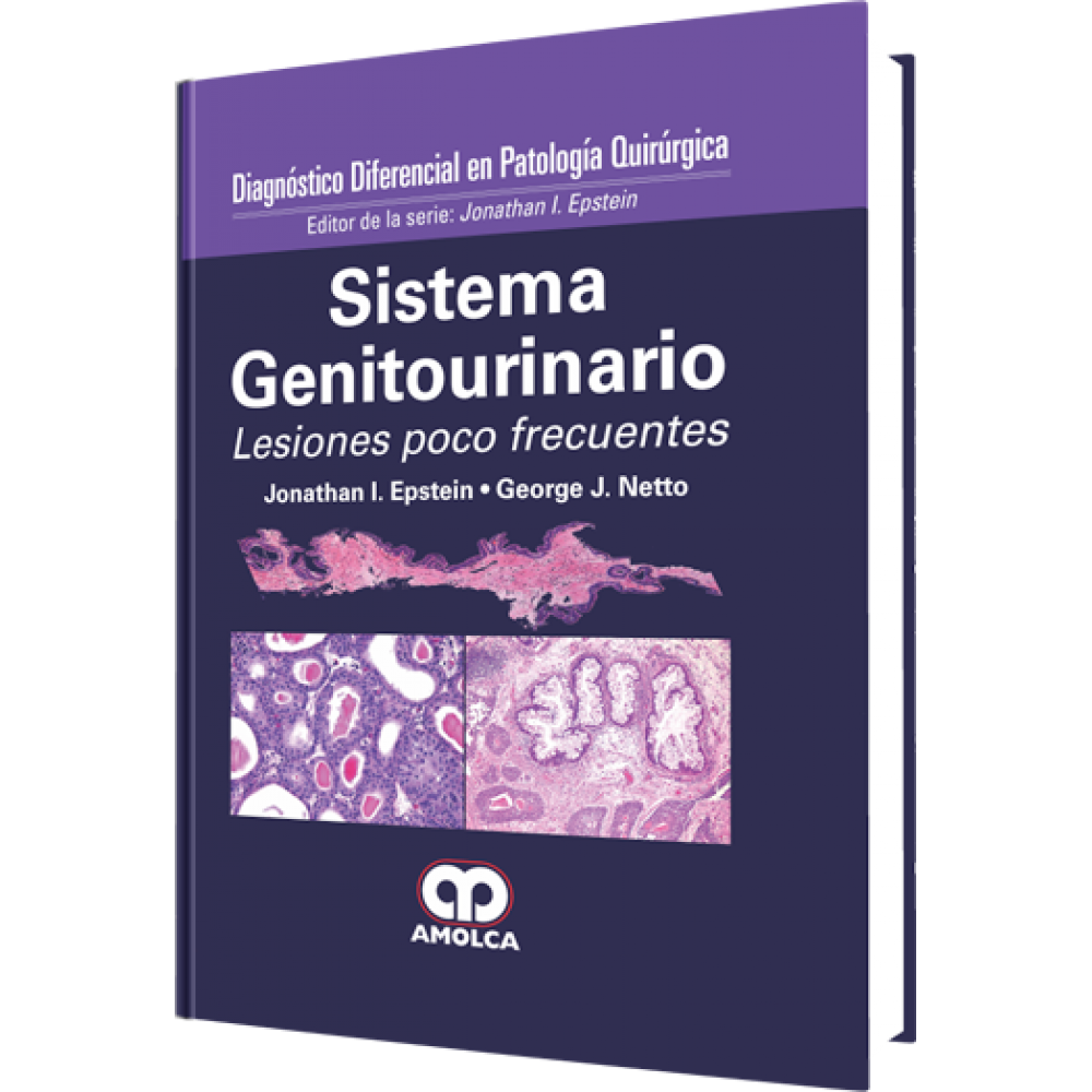 Diagnostico Diferencial en Patologia Quirurgica Sistema Genitourinario - Jonathan I. Epstein