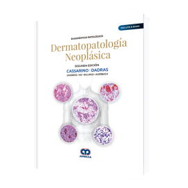 Diagnostico Patologico Dermatopatologia Neoplasica - David Cassarino