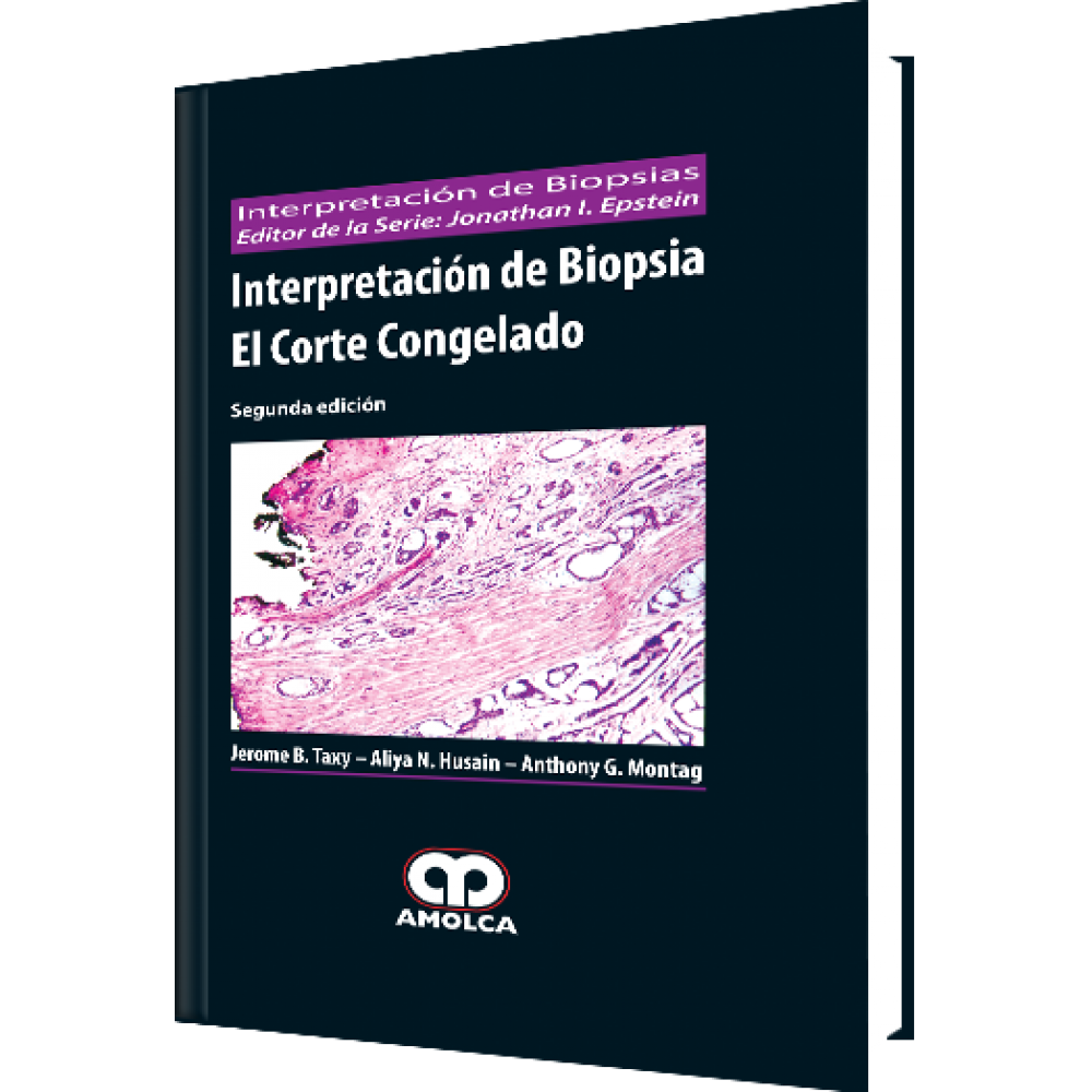 Interpretacion de Biopsia El Corte Congelado - Jerome B. Taxy