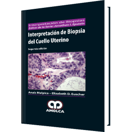 Interpretacion de Biopsia del Cuello Uterino - Anais Malpica