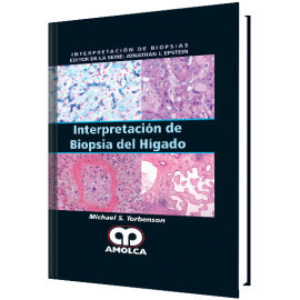 Torbenson Interpretacion de Biopsia del Higado - Michael S. Torbenson