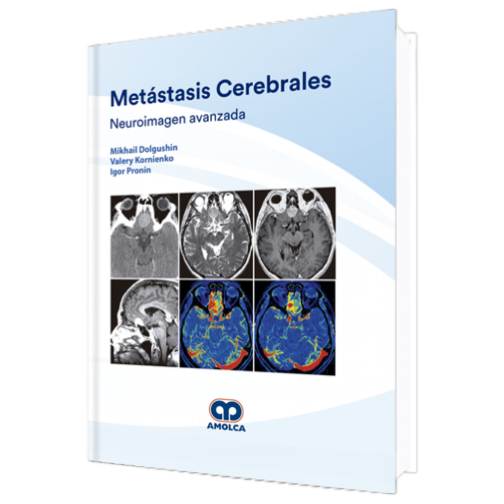 Dolgushin - Metastasis Cerebrales / Neuroimagen avanzada