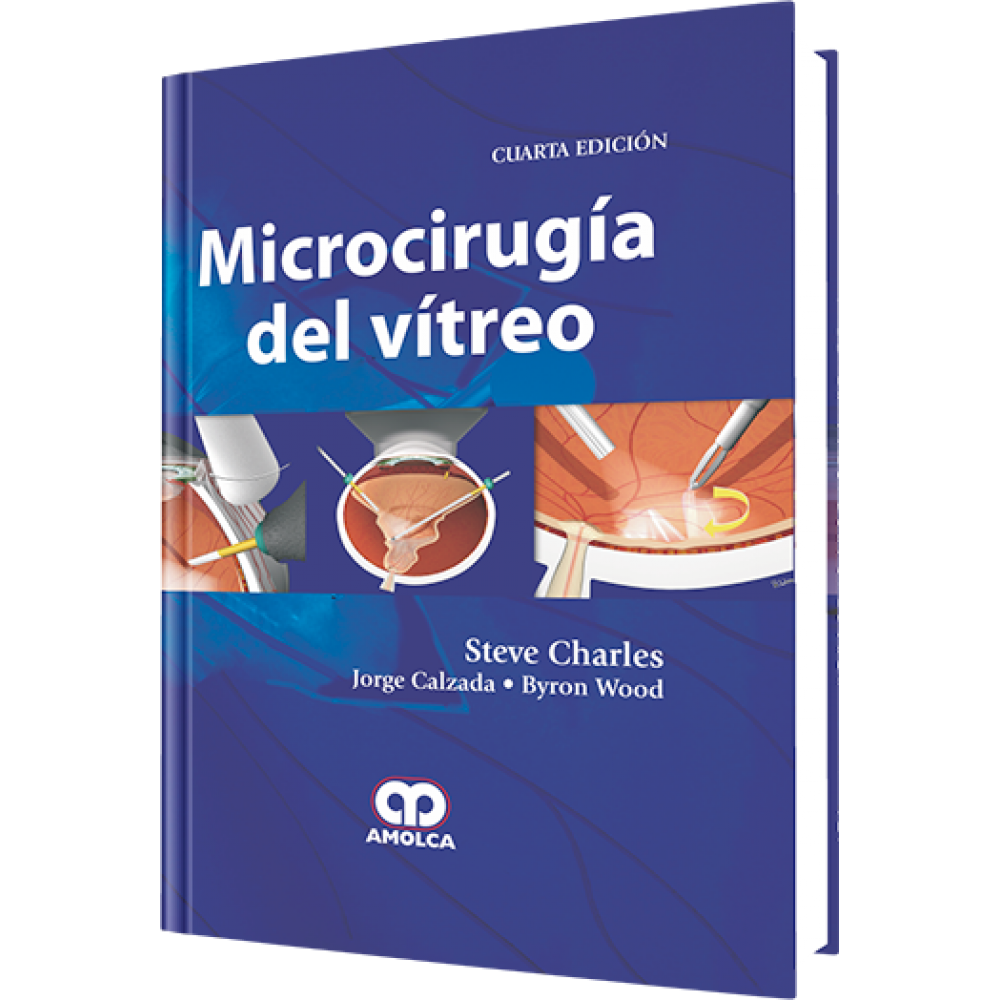 Charles - Microcirugia del Vitreo 4ª ed.