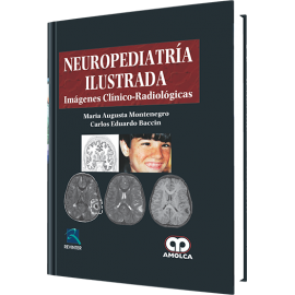 Neuropediatria Ilustrada - Maria Augusta Montenegro