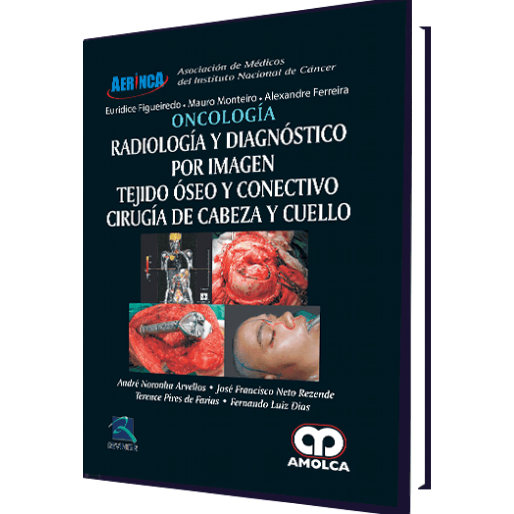 Noronha Arvellos Oncologia - Radiologia y Diagnostico por Imagen . Tejido Oseo y Conectivo Cirugia de Cabeza y Cuello -