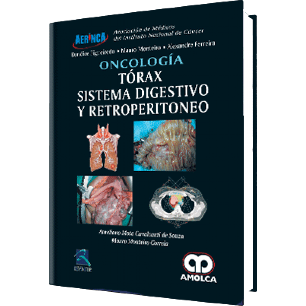 Mota - Oncologia - Torax, Sistema Digestivo y Retroperitoneo