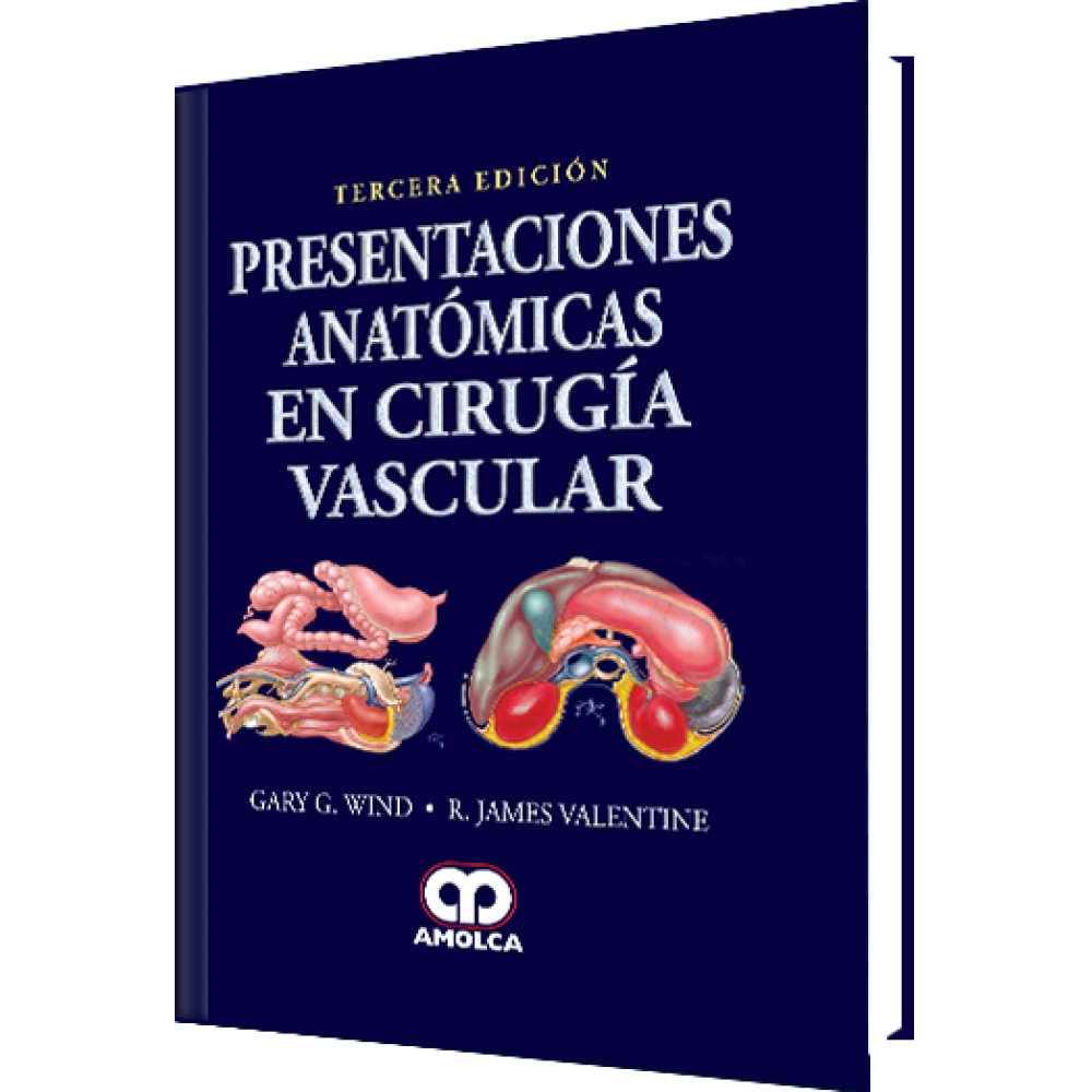 Wind - Presentaciones Anatomicas en Cirugia Vascular / Tercera edicion