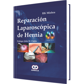 Mishra Reparacion Laparoscopica de Hernia