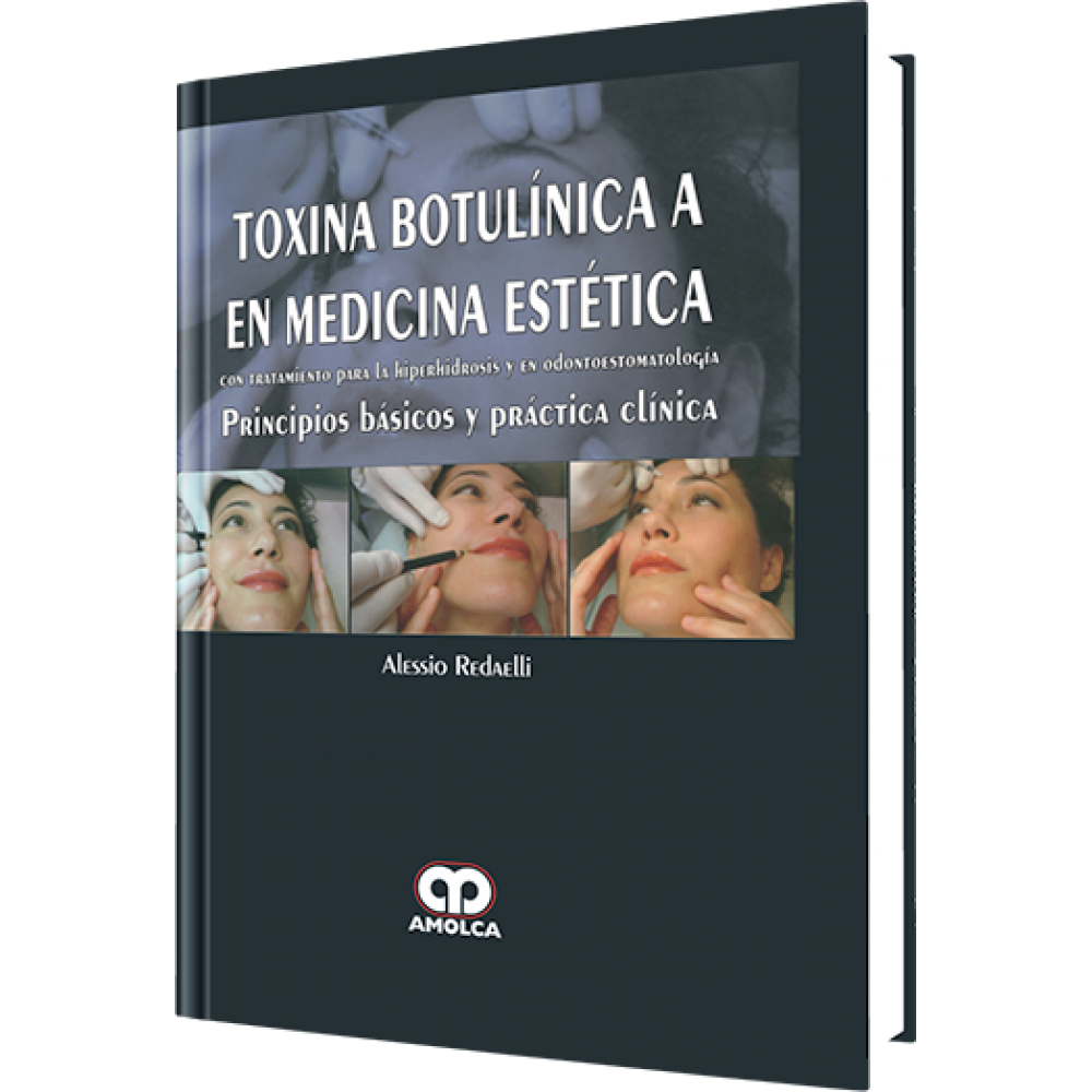 Toxina Botulinica A en Medicina Estetica - Alessio Redaelli