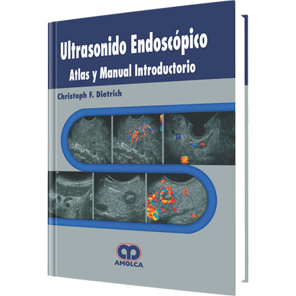 Ultrasonido Endoscopico - Christoph F. Dietrich