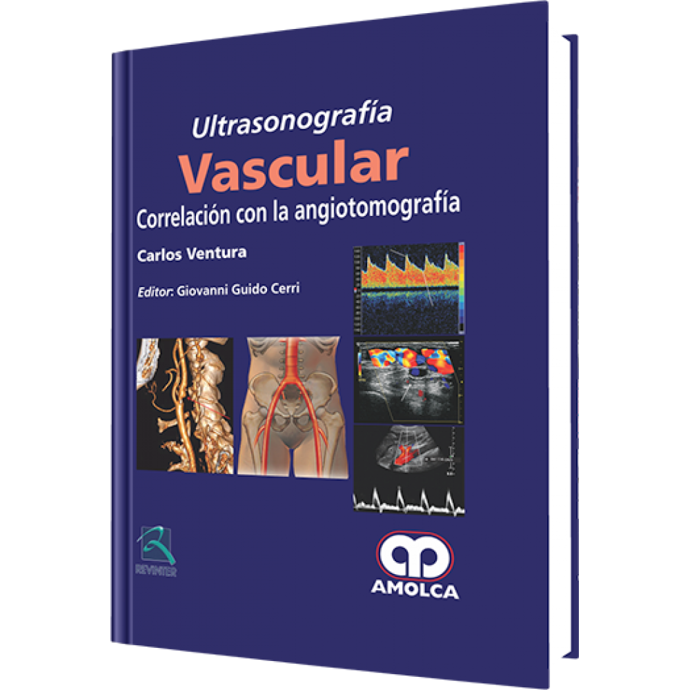 Ventura Ultrasonografia Vascular