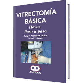 Martinez- Vitrectomia Basica