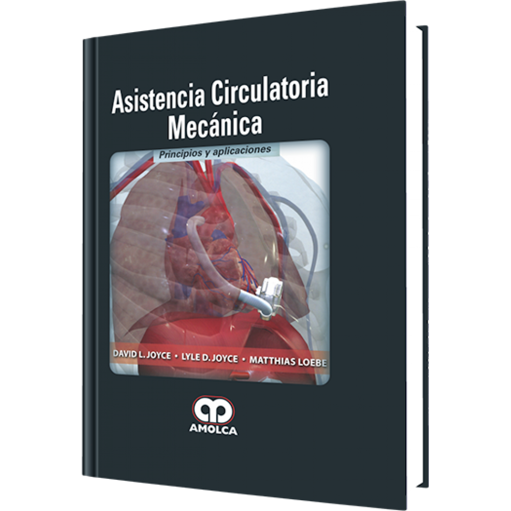 Asistencia Circulatoria Mecanica - David L. Joyce