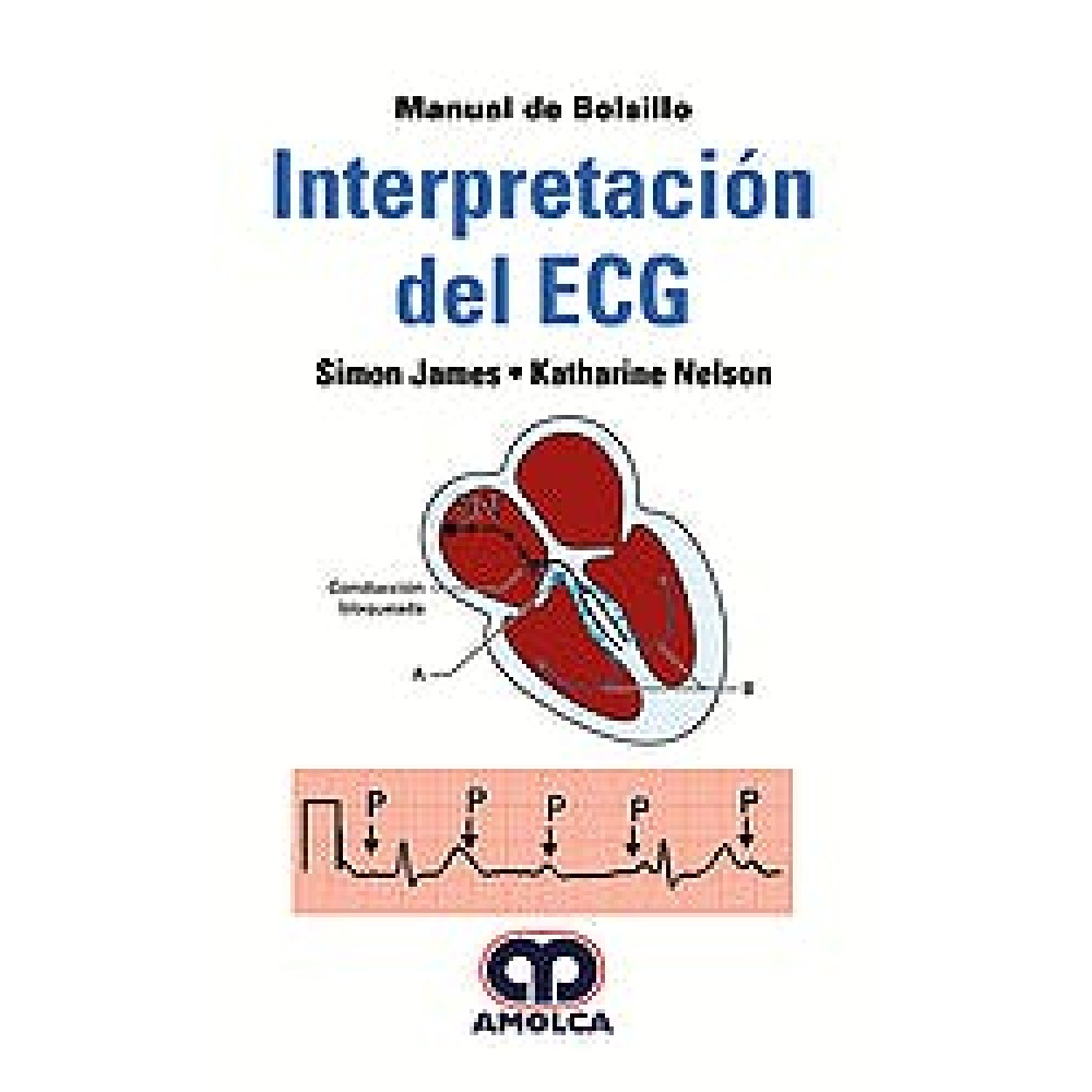 James Interpretacion del ECG. Manual de Bolsillo