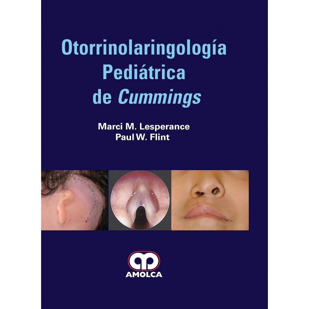 Lesperance Otorrinolaringologia Pediatrica de Cummings