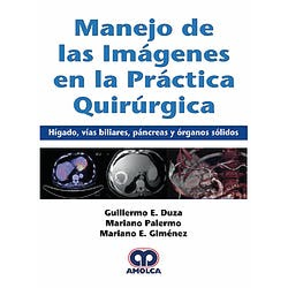Duza Manejo de las Imagenes en la Practica Quirurgica. Higado, Vias Biliares, Pancreas y organos Solidos