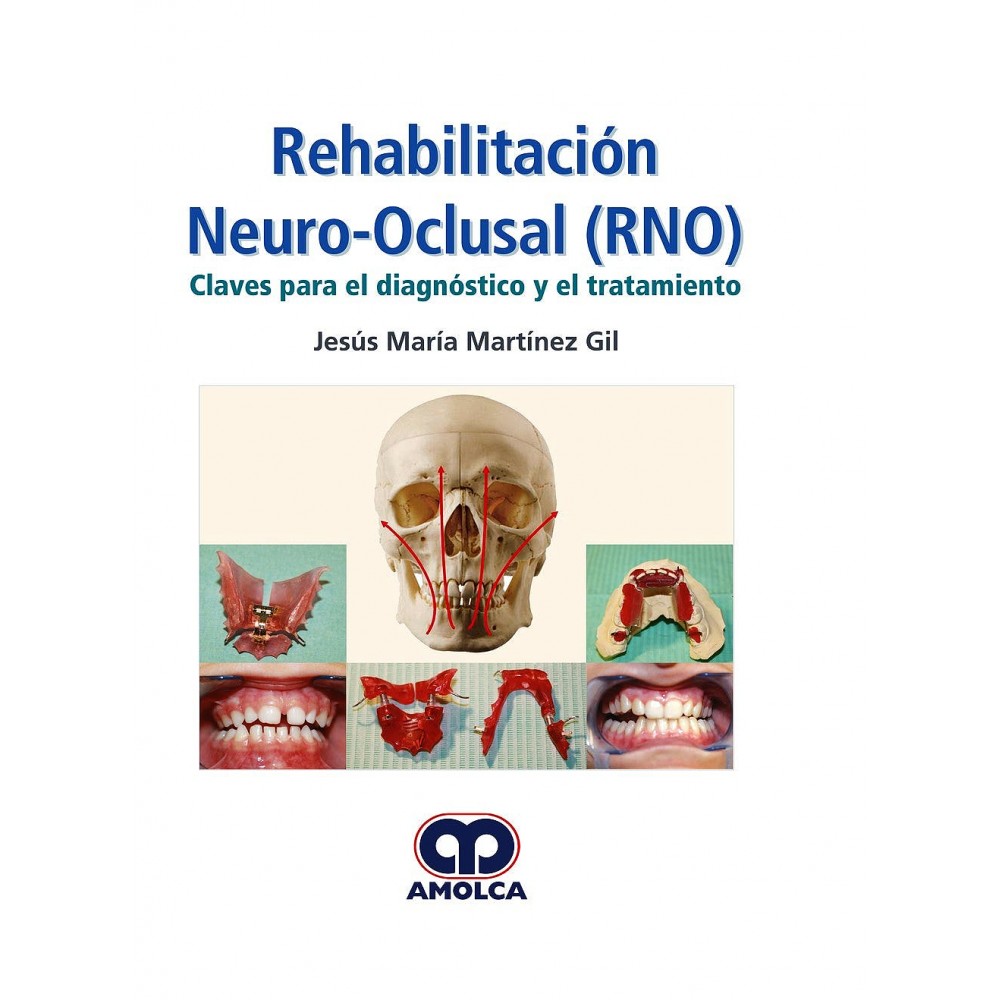 Martinez Rehabilitacion Neuro-Oclusal (RNO). Claves para el Diagnostico y el Tratamiento
