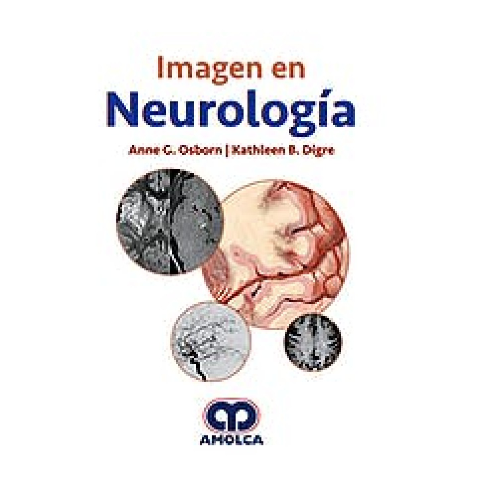 Osborn Imagen en Neurologia