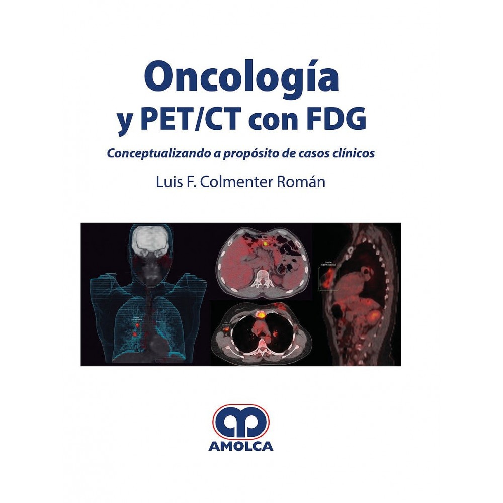 Colmenter Oncologia y PET/CT con FDG. Conceptualizando a Proposito de Casos Clinicos