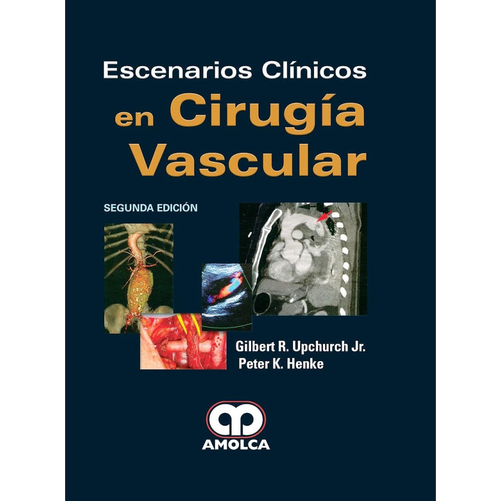 Upchurch, G. - Henke, P. Escenarios Clinicos en Cirugia Vascular