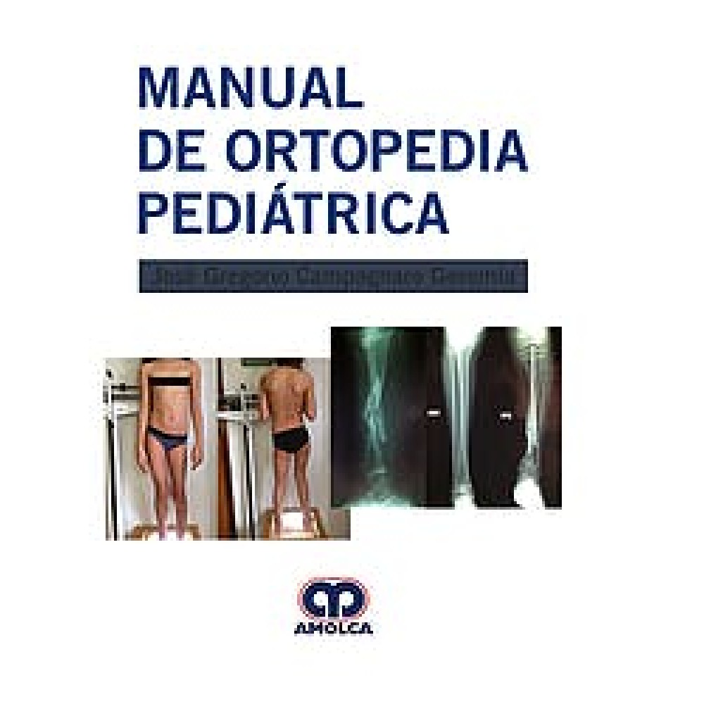 Campagnaro Manual de Ortopedia Pediatrica