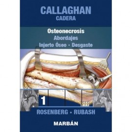 Callaghan Cadera N°1, Osteonecrosis