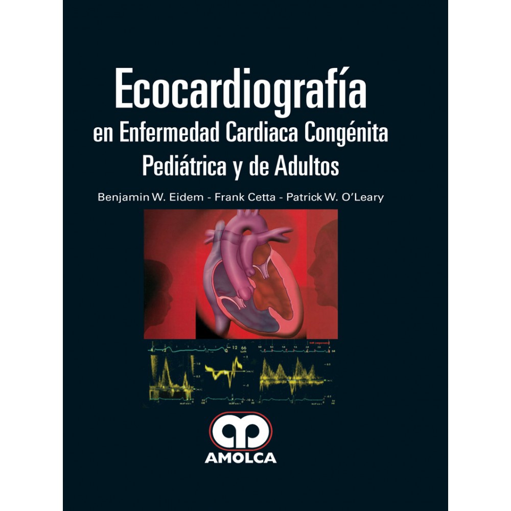Eidem  Ecocardiografia en Enfermedad Cardiaca Congenita Pediatrica y de Adultos
