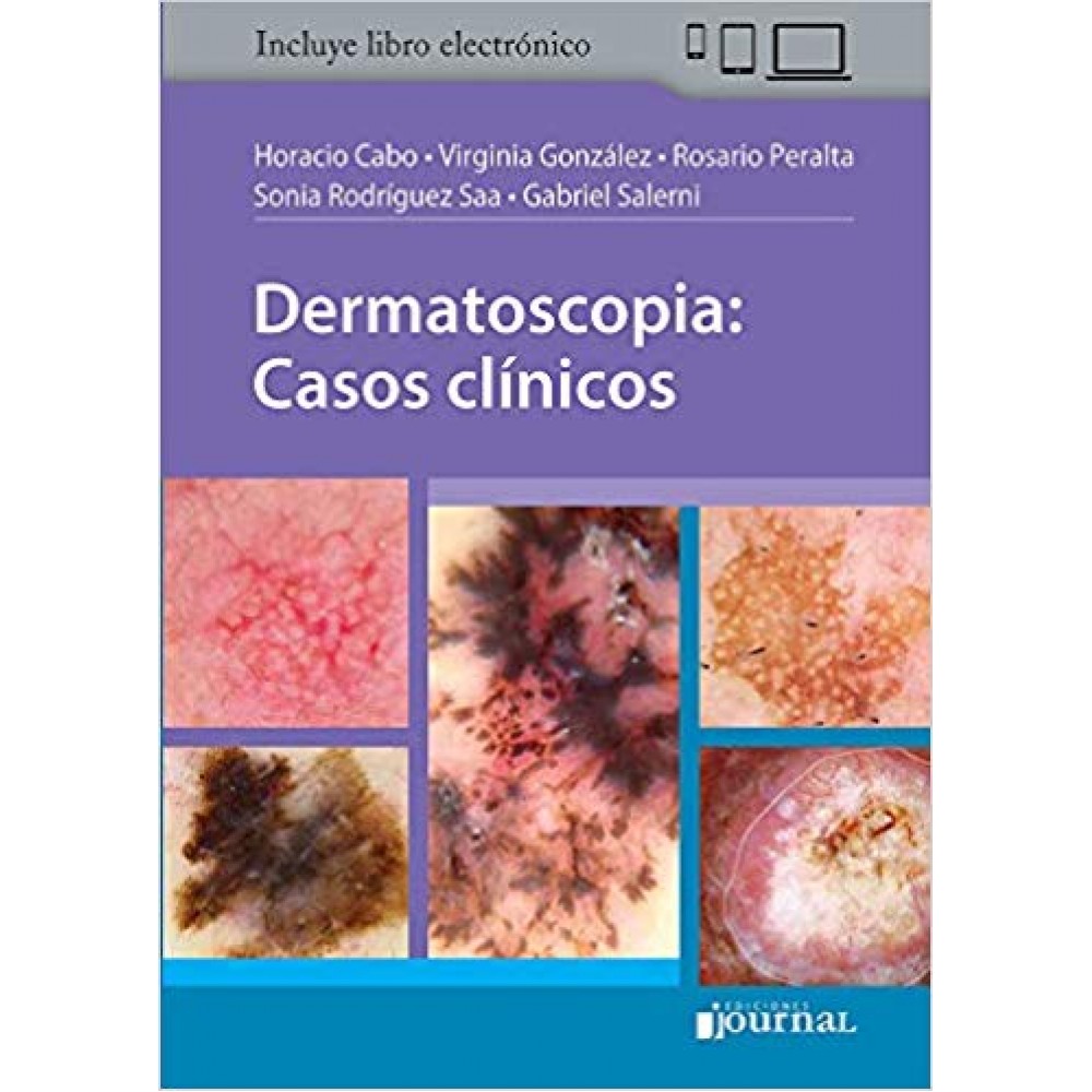 Horacio Cabo, Dermatoscopia: Casos clínicos