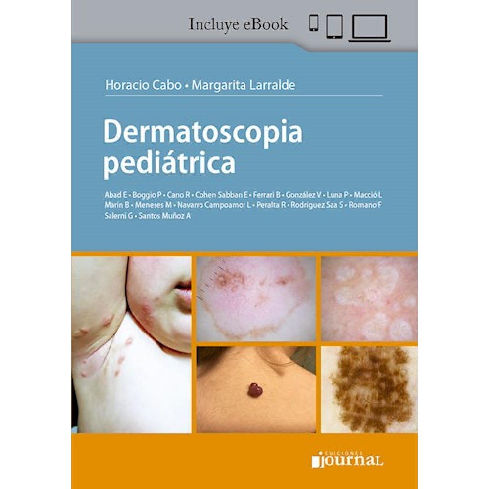 Dermatoscopia pediatrica por Cabo, Horacio - 9789878452012 - Journal