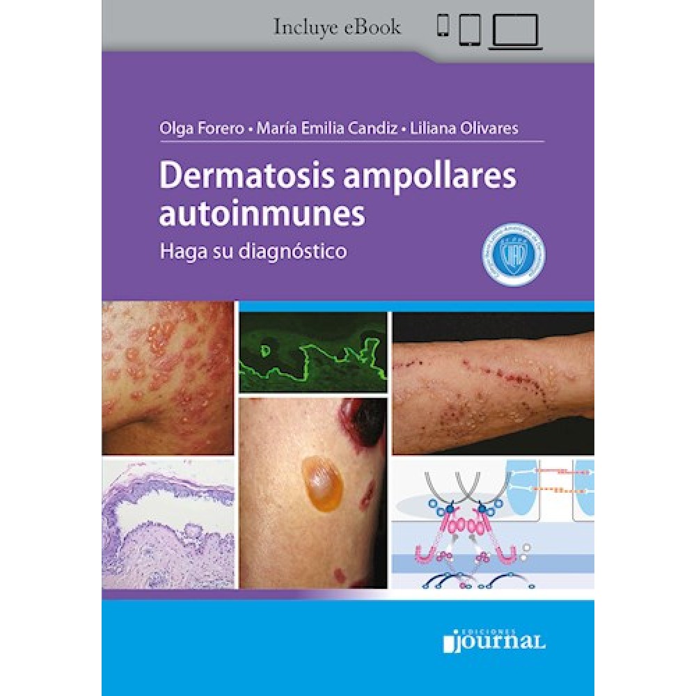 Dermatosis ampollares autoinmunes: Haga su diagnostico por Candiz, Maria Emilia - 9789878452098 - Journal