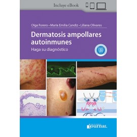 Dermatosis ampollares autoinmunes: Haga su diagnostico por Candiz, Maria Emilia - 9789878452098 - Journal