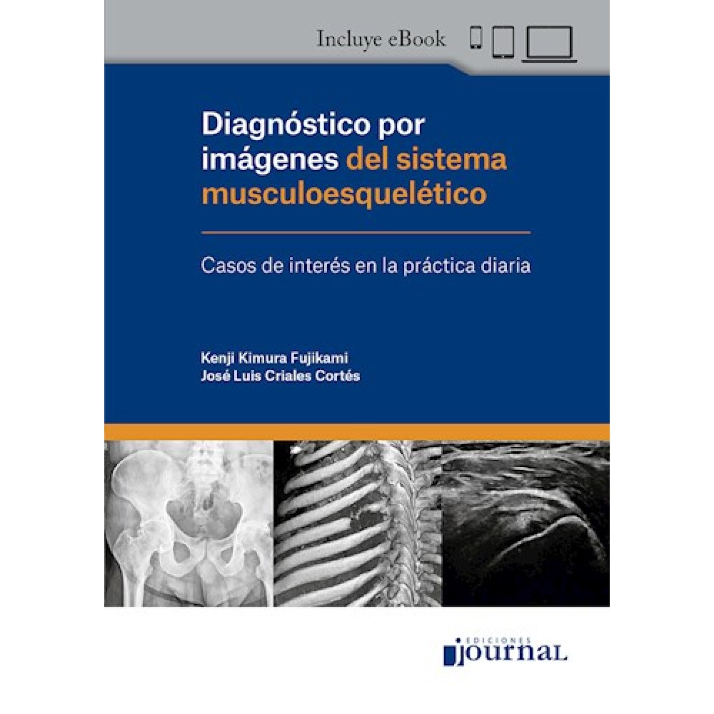 Diagnostico por imagenes del sistema musculoesqueletico por Kimura Fujikami, Kenji - 9789878452272 - Journal