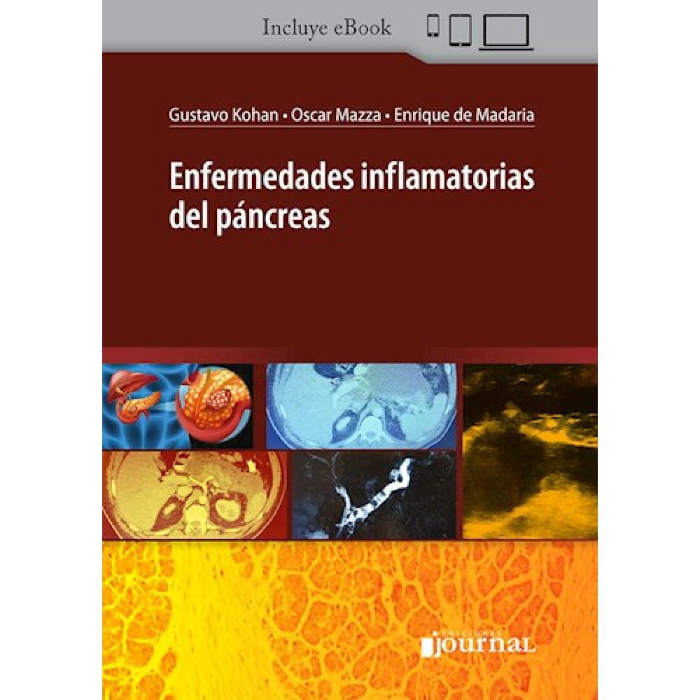 Enfermedades inflamatorias del pancreas por Kohan, Gustavo - 9789878452241 - Journal