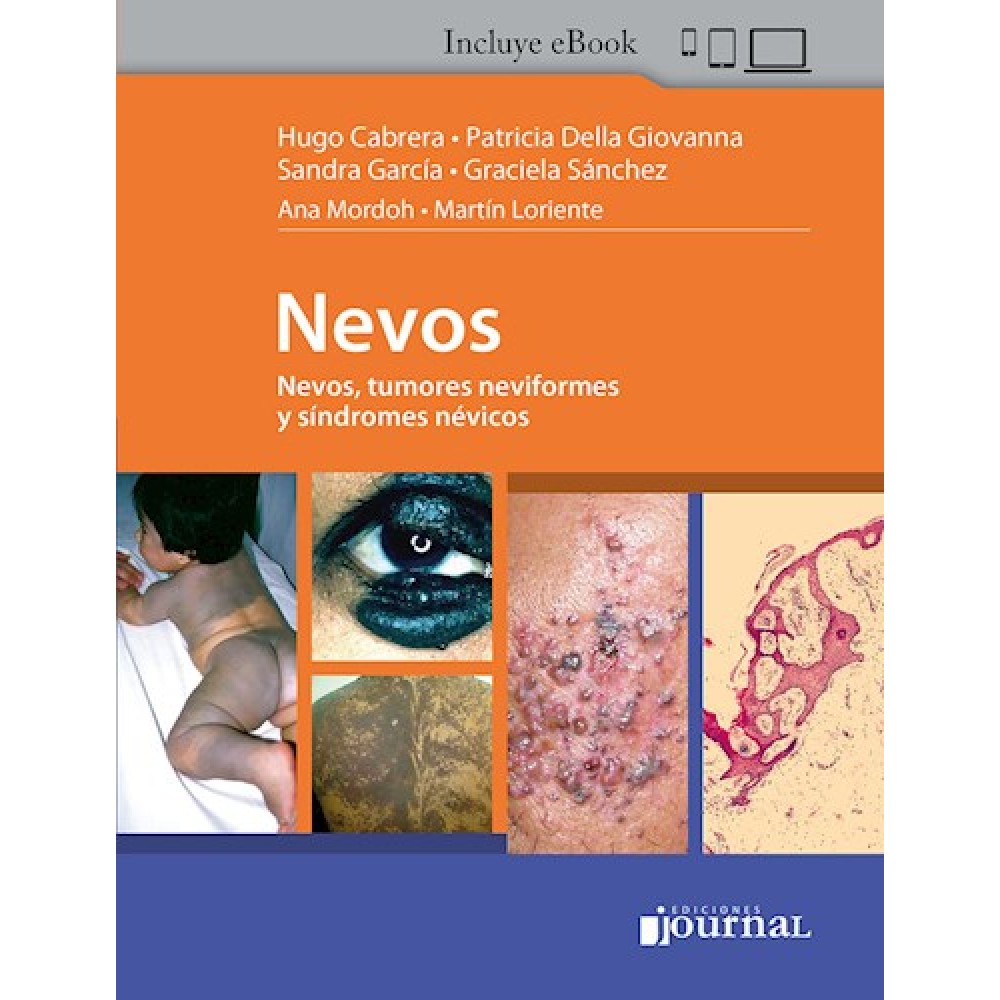Nevos por Cabrera, Hugo Nestor - 9789878452418 - Journal