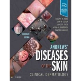 Andrews' Diseases of the Skin, 13th Edition