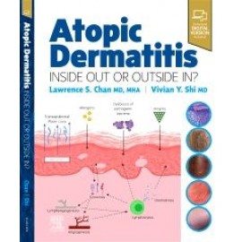 Atopic Dermatitis: Inside Out or Outside In, 1st Edition