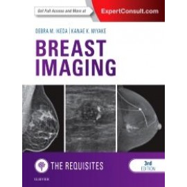 Breast Imaging: The Requisites, 3rd Edition - Ikeda