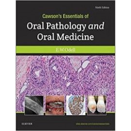 Cawson's Essentials of Oral Pathology and Oral Medicine, 9th Edition