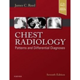 Chest Radiology, 7th Edition - Reed