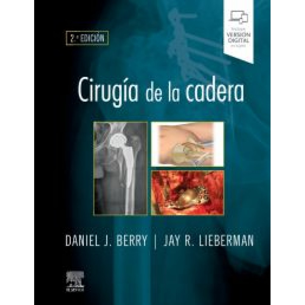 Cirugia de la cadera Berry & Lieberman 2 ed.